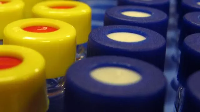 Image of yellow and blue vials